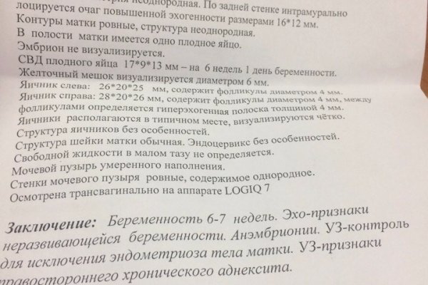 Кракен 16